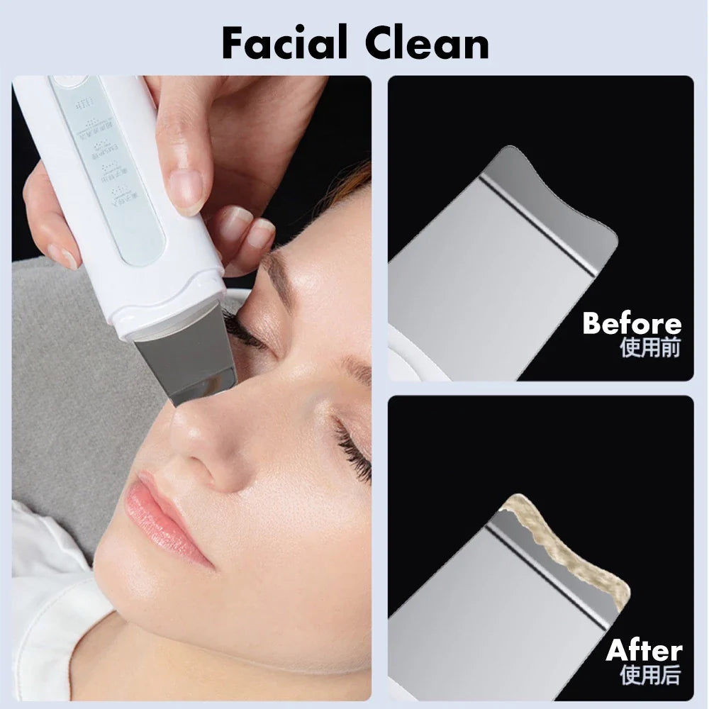 FreshFace™ Deep Pore Exfoliator