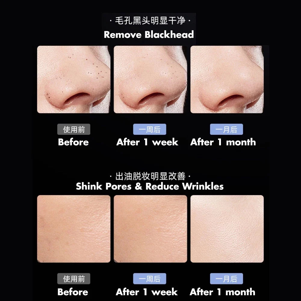 FreshFace™ Deep Pore Exfoliator