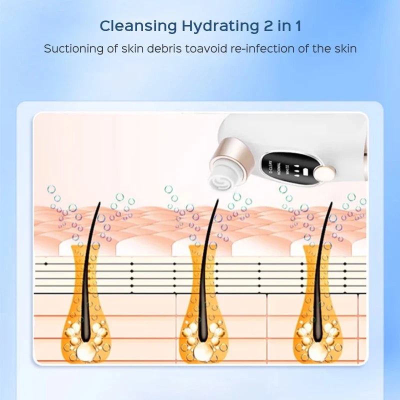 PureGlow™ HydroFacial Pore Extractor